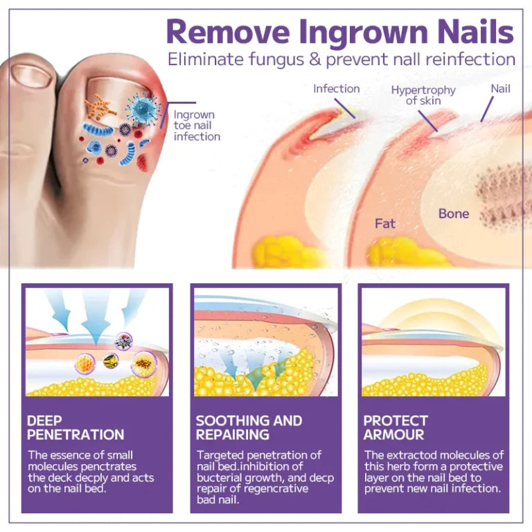 🔥BeeVenom Nail Fungus Solution - Buy 1 Get 1 Free🔥